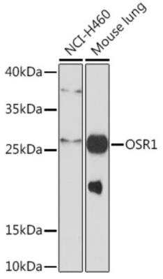 Western Blot: OSR1 AntibodyAzide and BSA Free [NBP2-94383]