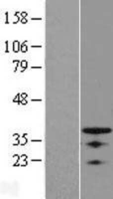 Western Blot: OSR1 Overexpression Lysate [NBL1-14003]