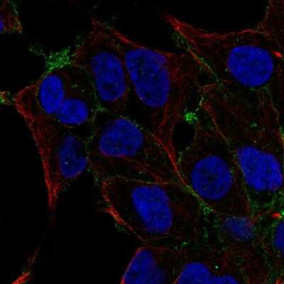Immunocytochemistry/ Immunofluorescence: OSR2 Antibody [NBP2-56333]