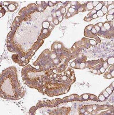 Immunohistochemistry-Paraffin: OSR2 Antibody [NBP2-30669]