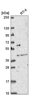 Western Blot: OSR2 Antibody [NBP2-56333]