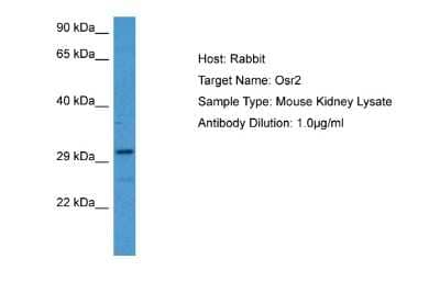 Western Blot: OSR2 Antibody [NBP2-85428]