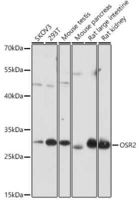 Western Blot: OSR2 AntibodyAzide and BSA Free [NBP3-05248]