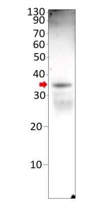 Western Blot: OSR2 Antibody [NBP3-12328]