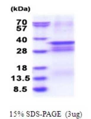 SDS-PAGE: Recombinant Human OSR2 His Protein [NBP2-51806]