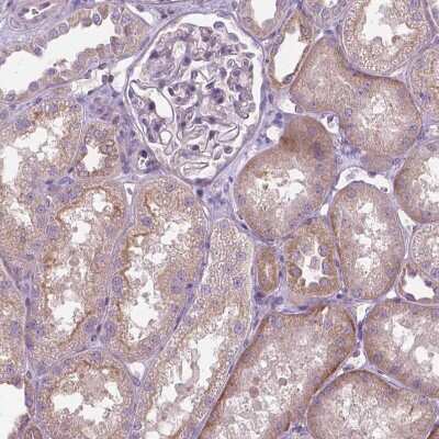 Immunohistochemistry-Paraffin: OSTB Antibody [NBP1-91108]