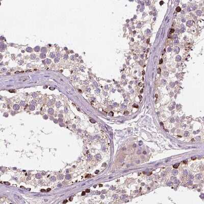 Immunohistochemistry-Paraffin: OSTB Antibody [NBP1-91108]