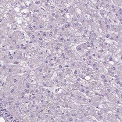 Immunohistochemistry-Paraffin: OSTB Antibody [NBP1-91108]