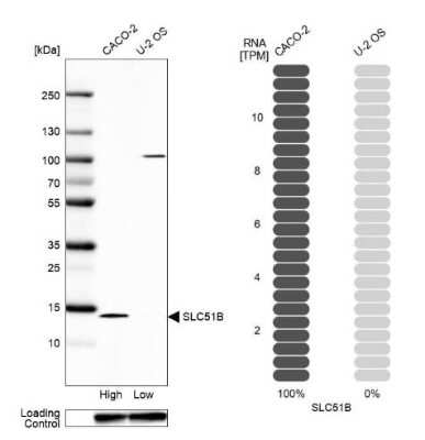 Western Blot: OSTB Antibody [NBP1-91108]