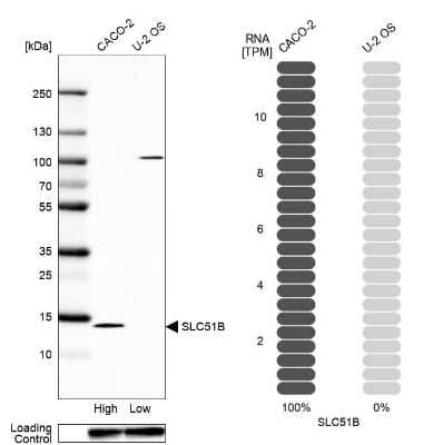 Western Blot: OSTB Antibody [NBP1-91108]