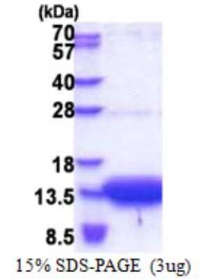 SDS-PAGE: Recombinant Human OSTB His Protein [NBP2-22816]