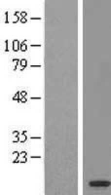 Western Blot: OSTCL Overexpression Lysate [NBL1-12585]