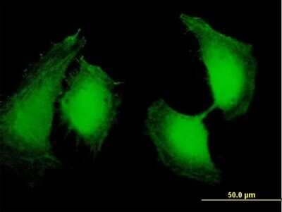 Immunocytochemistry/ Immunofluorescence: OSTF1 Antibody [H00026578-B01P]