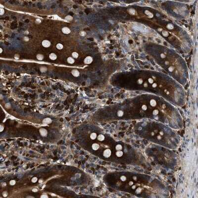 Immunohistochemistry-Paraffin: OSTF1 Antibody [NBP2-13718]