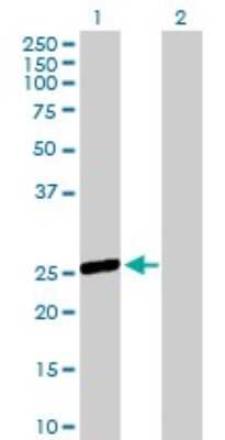 Western Blot: OSTF1 Antibody [H00026578-B01P]