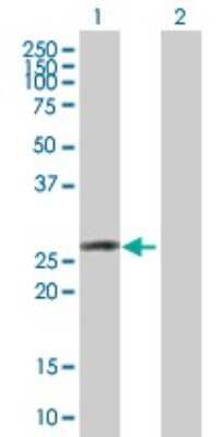 Western Blot: OSTF1 Antibody [H00026578-B02P]