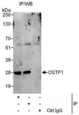 Western Blot: OSTF1 Antibody [NBP1-50036]