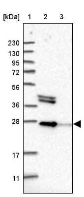 Western Blot: OSTF1 Antibody [NBP2-13718]