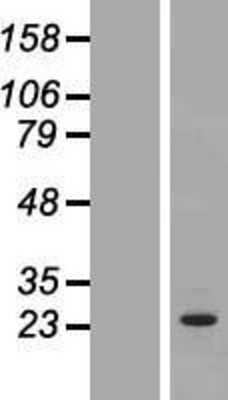 Western Blot: OSTF1 Overexpression Lysate [NBP2-07456]