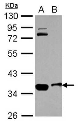 Western Blot: OSTM1 Antibody [NBP2-19641]