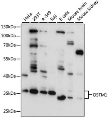 Western Blot: OSTM1 AntibodyAzide and BSA Free [NBP2-93631]