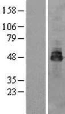 Western Blot: OSTM1 Overexpression Lysate [NBL1-14006]