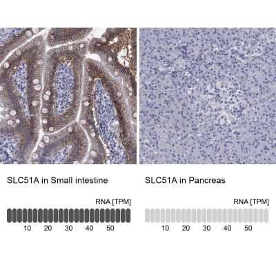 Immunocytochemistry/ Immunofluorescence: OSTalpha Antibody [NBP3-17140]