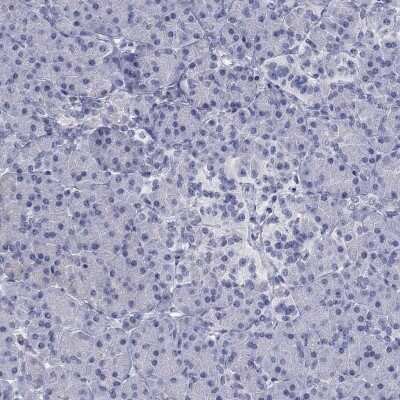 Immunohistochemistry-Paraffin: OSTalpha Antibody [NBP3-17140]