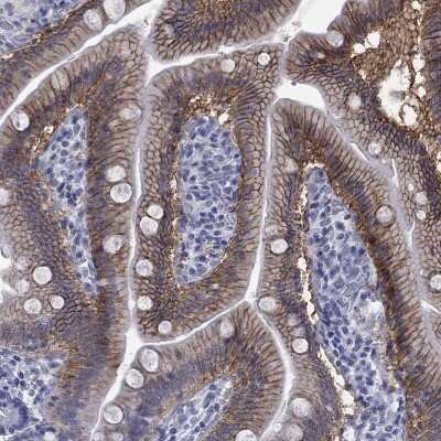Immunohistochemistry-Paraffin: OSTalpha Antibody [NBP3-17140]