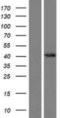 Western Blot: OSTalpha Overexpression Lysate [NBP2-04427]