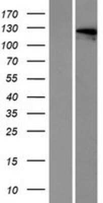 Western Blot: OTOA Overexpression Lysate [NBP2-05545]