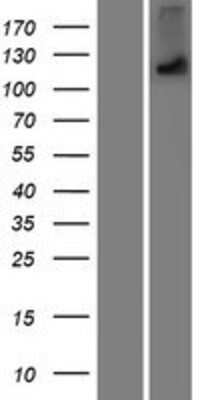 Western Blot: OTOA Overexpression Lysate [NBP2-10162]