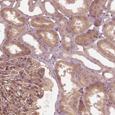 Immunohistochemistry-Paraffin: OTOGL Antibody [NBP2-54991]