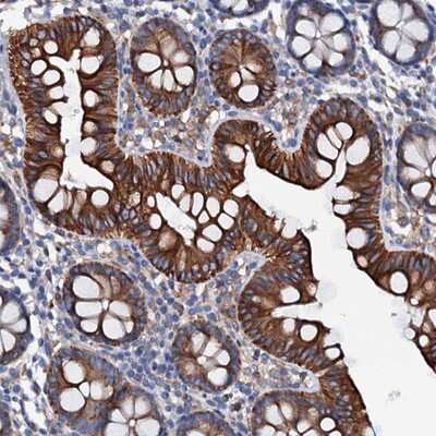 Immunohistochemistry-Paraffin: Otolin-1 Antibody [NBP1-90699]