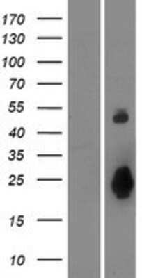 Western Blot: Otolin-1 Overexpression Lysate [NBP2-08497]