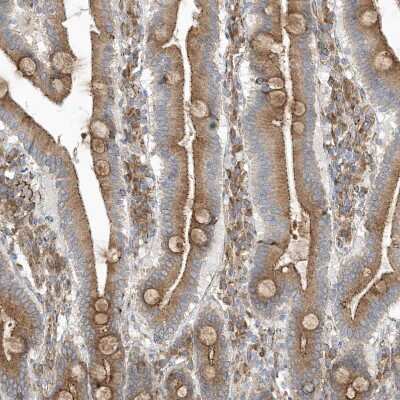 Immunohistochemistry-Paraffin: OTOP1 Antibody [NBP1-86306]