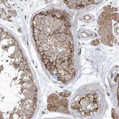 Immunohistochemistry-Paraffin: OTOP1 Antibody [NBP1-86306]