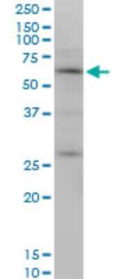 Western Blot: OTOP2 Antibody (4F6) [H00092736-M10]