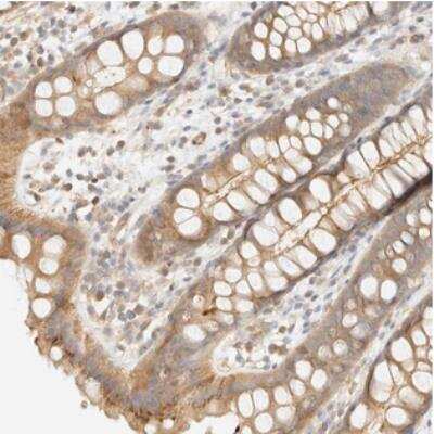 Immunohistochemistry-Paraffin: OTOP2 Antibody [NBP2-30867]