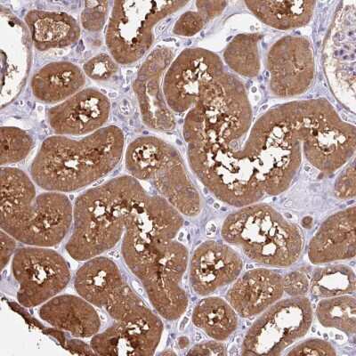 Immunohistochemistry: OTOP2 Antibody [NBP2-33672]