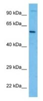 Western Blot: OTOP3 Antibody [NBP3-10201]