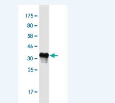 Western Blot: OTOS Antibody (6C6) [H00150677-M02-100ug]