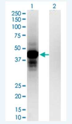 Western Blot: OTP Antibody (8E12) [H00023440-M03-100ug]
