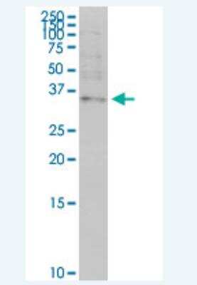 Western Blot: OTP Antibody (8E12) [H00023440-M03-100ug]