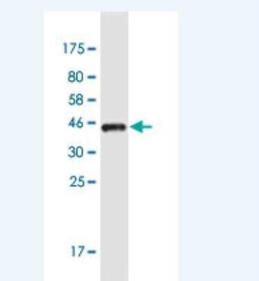 Western Blot: OTP Antibody (8E12) [H00023440-M03-100ug]