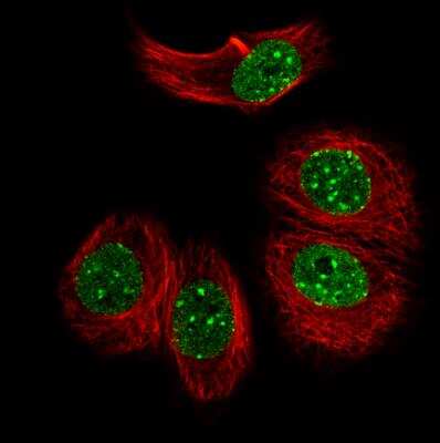 Immunocytochemistry/ Immunofluorescence: OTP Antibody (CL11225) [NBP3-15136]