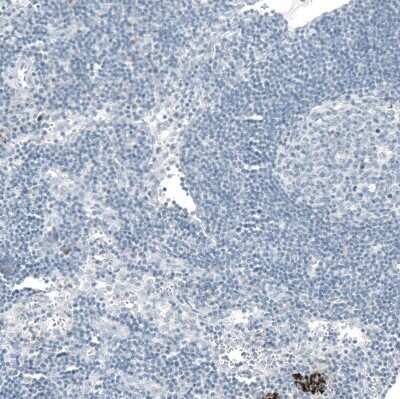 Immunohistochemistry-Paraffin: OTP Antibody (CL11225) [NBP3-15136]