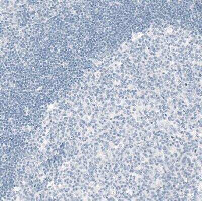 Immunohistochemistry-Paraffin: OTP Antibody (CL11225) [NBP3-15136]