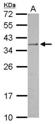 Western Blot: OTP Antibody [NBP2-19642]