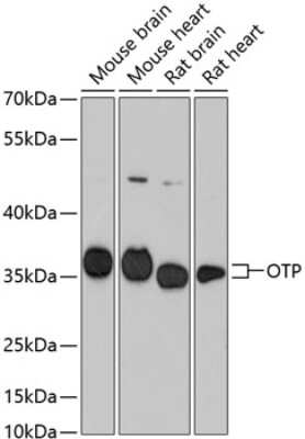 Western Blot: OTP AntibodyAzide and BSA Free [NBP2-94084]